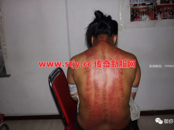 想不到吧！当年的战士其实是个“刮痧师傅”？