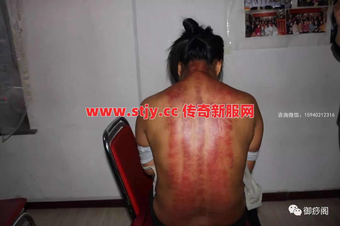 想不到吧!当年的战士其实是个“刮痧师傅”?